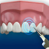 Ultrasonic Dental Instrument
